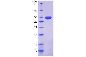 SDS-PAGE (SDS) image for Dishevelled Associated Activator of Morphogenesis 1 (DAAM1) (AA 1-250) protein (His tag) (ABIN6239090) (DAAM1 Protein (AA 1-250) (His tag))