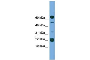 WB Suggested Anti-TMEM107 Antibody Titration:  0. (TMEM107 Antikörper  (N-Term))