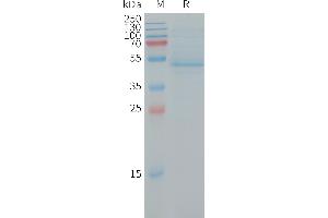 RHOC Protein (AA 1-189) (Fc Tag)