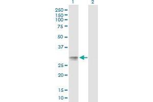 Lane 1: C20orf70 transfected lysate ( 27 KDa) Lane 2: Non-transfected lysate. (C20orf70 293T Cell Transient Overexpression Lysate(Denatured))