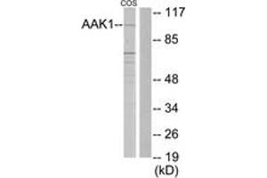 Western blot analysis of extracts from COS7 cells, using AAK1 Antibody. (AAK1 Antikörper  (AA 271-320))