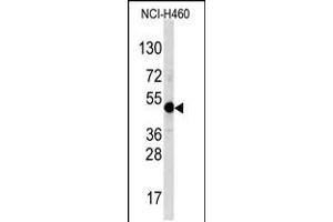 Western blot analysis of TFAP2A Antibody in NCI-H460 cell line lysates (35ug/lane) (TFAP2A Antikörper  (C-Term))