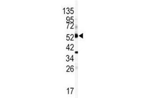 Western blot analysis of CYP1A1 antibody and mouse lung tissue lysate (CYP1A1 Antikörper  (AA 252-280))