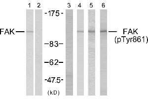 Western blot analysis using FAK (Ab-861) antibody (#B7082, Line 1 and 2) and FAK (phospho-Tyr861) antibody (#11059, Line 3, 4, 5 and 6). (FAK Antikörper  (Tyr861))