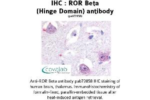 Image no. 1 for anti-RAR-Related Orphan Receptor B (RORB) antibody (ABIN1738925) (RORB Antikörper)