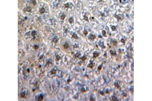 Used in DAB staining on fromalin fixed paraffin-embedded Liver tissue (MYB Antikörper  (AA 35-291))