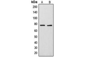 Western blot analysis of ARHGAP18 expression in MDAMB231 (A), U2OS (B) whole cell lysates. (ARHGAP18 Antikörper  (C-Term))