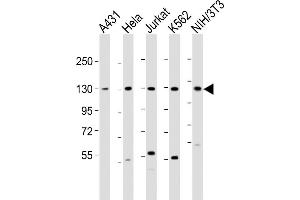 All lanes : Anti-DDX42 Antibody (N-Term) at 1:2000 dilution Lane 1: A431 whole cell lysate Lane 2: Hela whole cell lysate Lane 3: Jurkat whole cell lysate Lane 4: K562 whole cell lysate Lane 5: NIH/3T3 whole cell lysate Lysates/proteins at 20 μg per lane. (DDX42 Antikörper  (AA 104-138))