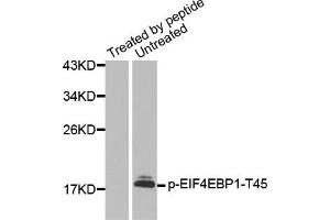 Western Blotting (WB) image for anti-Eukaryotic Translation Initiation Factor 4E Binding Protein 1 (EIF4EBP1) (pThr45) antibody (ABIN1870151) (eIF4EBP1 Antikörper  (pThr45))
