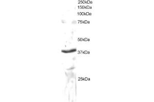 Western Blotting (WB) image for anti-Sec61 alpha 1 Subunit (SEC61A1) (C-Term) antibody (ABIN2465299) (SEC61A1 Antikörper  (C-Term))