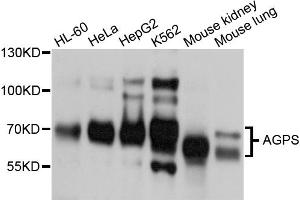 Western blot analysis of extracts of various cell lines, using AGPS antibody (ABIN5997208) at 1/1000 dilution. (AGPS Antikörper)