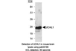 Image no. 1 for anti-Ubiquitin Carboxyl-terminal Esterase L1 (Ubiquitin Thiolesterase) (UCHL1) (AA 100-200) antibody (ABIN363498) (UCHL1 Antikörper  (AA 100-200))