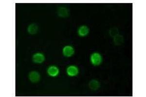 Immunofluorescence analysis of B lymphocytes using CD20 antibody. (CD20 Antikörper)