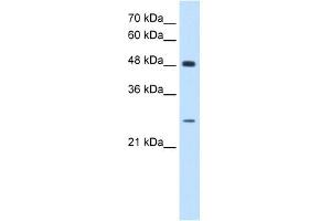 SH3BGR antibody used at 0. (SH3BGR Antikörper  (N-Term))