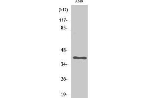 Western Blot analysis of various cells using LAT Polyclonal Antibody. (LAT Antikörper)