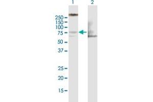 Western Blot analysis of LIMK1 expression in transfected 293T cell line by LIMK1 MaxPab polyclonal antibody. (LIM Domain Kinase 1 Antikörper  (AA 1-647))