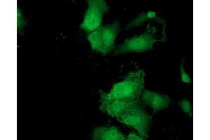 Anti-MOBKL2B mouse monoclonal antibody (ABIN2453315) immunofluorescent staining of COS7 cells transiently transfected by pCMV6-ENTRY MOBKL2B (RC205977). (MOBKL2B Antikörper)