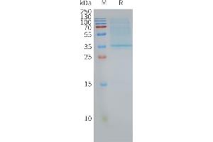Human CD63-Nanodisc, Flag Tag on SDS-PAGE (CD63 Protein (CD63))