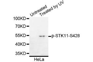 Western blot analysis of extracts of HeLa cells, using Phospho-STK11-S428 antibody. (LKB1 Antikörper  (pSer428))