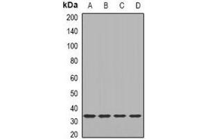 Western blot analysis of LACI expression in HEK293T (A), MCF7 (B), mouse lung (C), mouse heart (D) whole cell lysates. (LacI Antikörper)