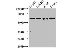 Western Blot Positive WB detected in: HepG2 whole cell lysate, HEK293 whole cell lysate, A549 whole cell lysate, Mouse heart tissue All lanes: TRIM5 antibody at 3 μg/mL Secondary Goat polyclonal to rabbit IgG at 1/50000 dilution Predicted band size: 57, 47, 41, 38, 32, 30 kDa Observed band size: 70 kDa (TRIM5 Antikörper  (AA 1-493))