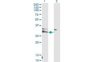 Western Blot analysis of VWF expression in transfected 293T cell line by VWF monoclonal antibody (M02), clone 1A11. (VWF Antikörper  (AA 1-273))