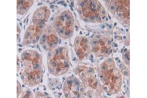 IHC-P analysis of stomach tissue, with DAB staining. (PTPN22 Antikörper  (AA 1-233))