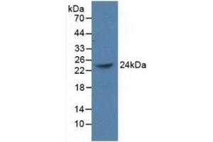 Detection of Recombinant PCGF4, Human using Polyclonal Antibody to Polycomb Group Ring Finger Protein 4 (PCGF4) (BMI1 Antikörper  (AA 152-289))
