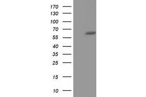 HEK293T cells were transfected with the pCMV6-ENTRY control (Left lane) or pCMV6-ENTRY KLHL2 (Right lane) cDNA for 48 hrs and lysed. (KLHL2 Antikörper  (AA 1-100, AA 494-593))