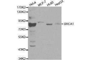 Western blot analysis of extracts of various cell lines, using BRCA1 antibody. (BRCA1 Antikörper  (AA 120-220))