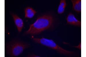 Immunofluorescence staining of methanol-fixed HeLa cells using Phospho-NOS3-S1177 antibody (ABIN2988223). (ENOS Antikörper  (pSer1177))