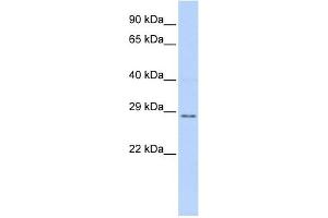 TFPI2 antibody used at 1 ug/ml to detect target protein. (TFPI2 Antikörper  (Middle Region))