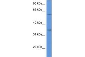 Image no. 1 for anti-CD34 (CD34) (AA 188-237) antibody (ABIN6746929) (CD34 Antikörper  (AA 188-237))