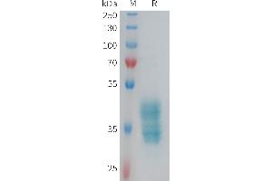 Human F2RL3 Protein, hFc Tag on SDS-PAGE under reducing condition. (F2RL3 Protein (AA 48-78) (Fc Tag))