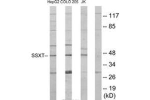 Western blot analysis of extracts from HepG2/Jurkat/COLO205 cells, using SSXT Antibody. (SS18 Antikörper  (AA 1-50))