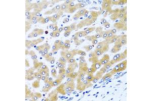 Immunohistochemistry of paraffin-embedded human liver using CCL21 antibody (ABIN5970974) at dilution of 1/100 (40x lens). (CCL21 Antikörper)