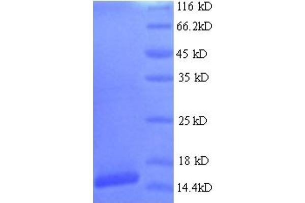 HPV16 E7 Protein (AA 1-105, full length) (His tag)