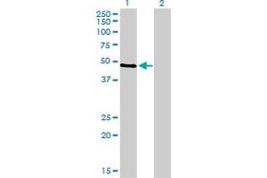 Western Blotting (WB) image for anti-Tumor Protein P53 (TP53) (AA 94-202) antibody (ABIN598982) (p53 Antikörper  (AA 94-202))