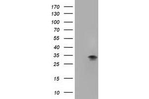 Western Blotting (WB) image for anti-Four and A Half LIM Domains 1 (FHL1) antibody (ABIN1500974) (FHL1 Antikörper)