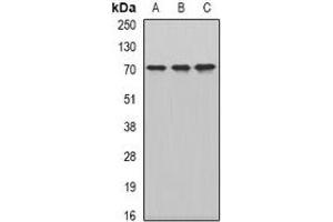 Western blot analysis of CKAP4 expression in HepG2 (A), MCF7 (B), mouse testis (C) whole cell lysates. (CKAP4 Antikörper)