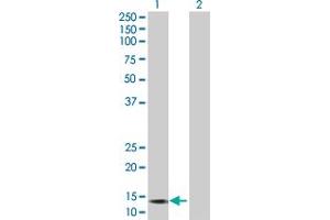 Western Blotting (WB) image for GALNT3 293T Cell Transient Overexpression Lysate(Denatured) (ABIN1331904)