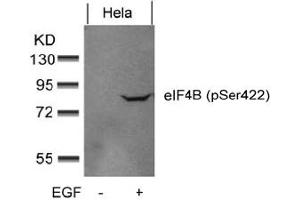 Image no. 2 for anti-Eukaryotic Translation Initiation Factor 4B (EIF4B) (pSer422) antibody (ABIN401564) (EIF4B Antikörper  (pSer422))