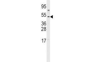 Western Blotting (WB) image for anti-C-Fos Induced Growth Factor (Vascular Endothelial Growth Factor D) (Figf) antibody (ABIN3002601) (VEGFD Antikörper)