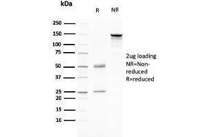 SDS-PAGE Analysis Purified CD80 Mouse Monoclonal Antibody (C80/2776). (CD80 Antikörper  (AA 35-142))