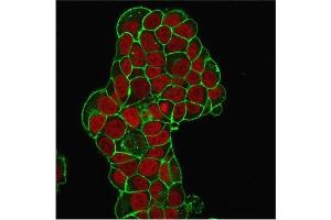 Immunofluorescence Analysis of PFA-fixed MCF-7 cells. (CD47 Antikörper)