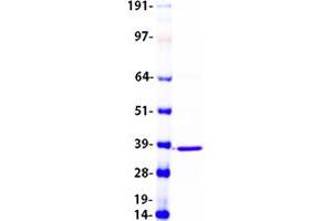 DEGS1 Protein (Transcript Variant 1) (Myc-DYKDDDDK Tag)