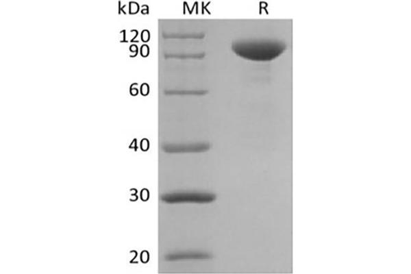 IL23 Protein (Fc Tag)