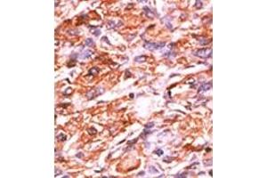 Image no. 2 for anti-Retinoblastoma 1 (RB1) (pSer811) antibody (ABIN358217) (Retinoblastoma 1 Antikörper  (pSer811))