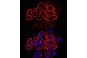 Confocal immunofluorescence analysis of HeLa cells using Cytokeratin 17 (KRT17) antibody (ABIN6130112, ABIN6143023, ABIN6143024 and ABIN6213626) at dilution of 1:200. (KRT17 Antikörper  (AA 133-432))