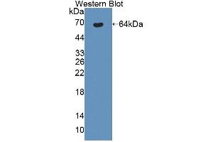 Western blot analysis of the recombinant protein. (Bestrophin 1 Antikörper  (AA 292-585))